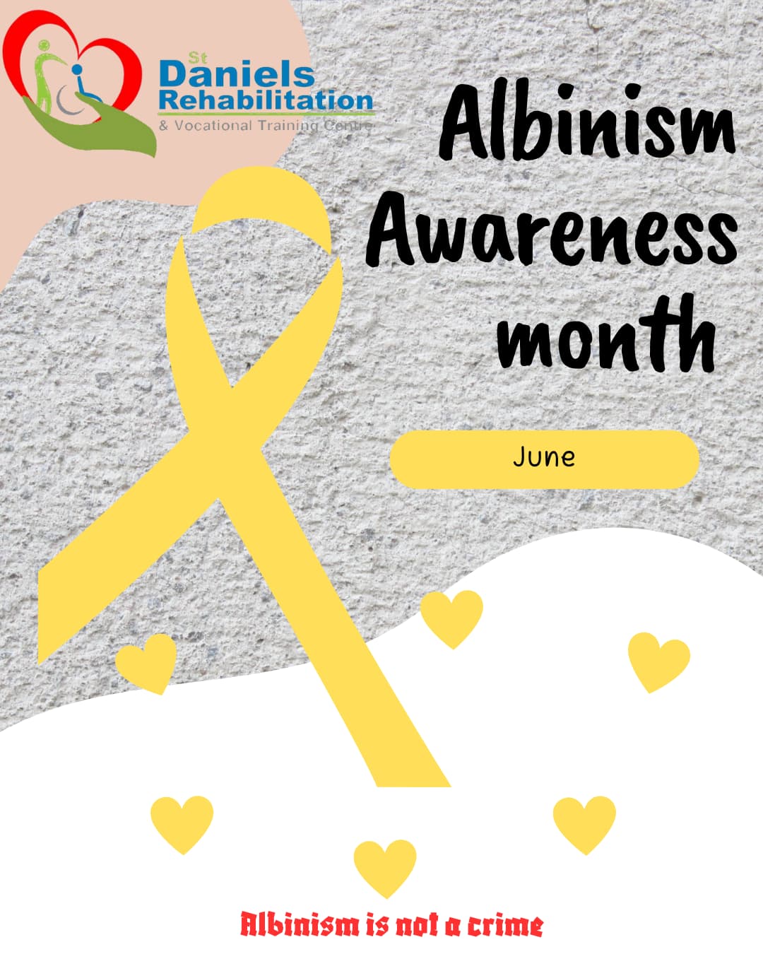 Albinism Awareness Month: June